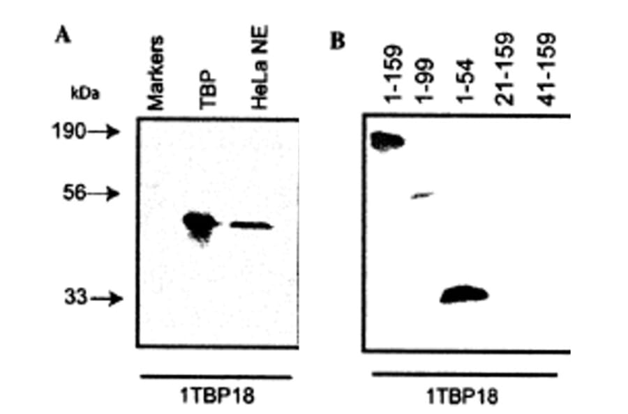 Validation Data - Anti-TATA Binding Protein Antibody [1TBP18] - BSA and Azide free (A304455)