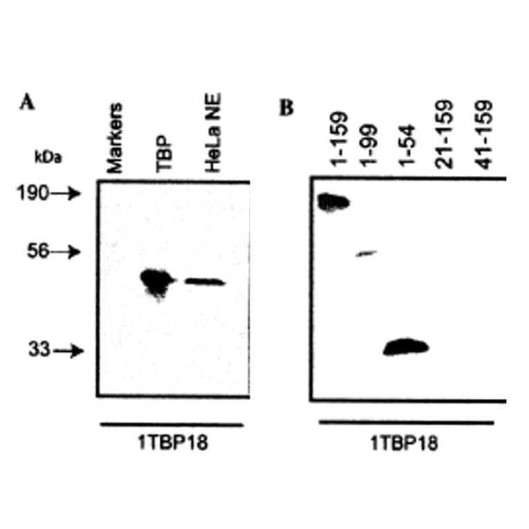 Validation Data - Anti-TATA Binding Protein Antibody [1TBP18] - BSA and Azide free (A304455)