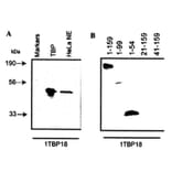 Validation Data - Anti-TATA Binding Protein Antibody [1TBP18] - BSA and Azide free (A304455)