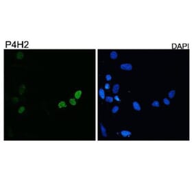 Validation Data - Anti-DUX4 Antibody [P4H2] - BSA and Azide free (A304463)