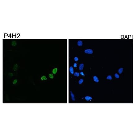 Validation Data - Anti-DUX4 Antibody [P4H2] - BSA and Azide free (A304463)
