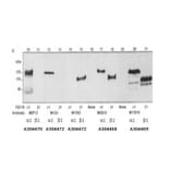 Validation Data - Anti-Fibroblast Growth Factor Receptor 1 Antibody [M5G10] - BSA and Azide free (A304468)