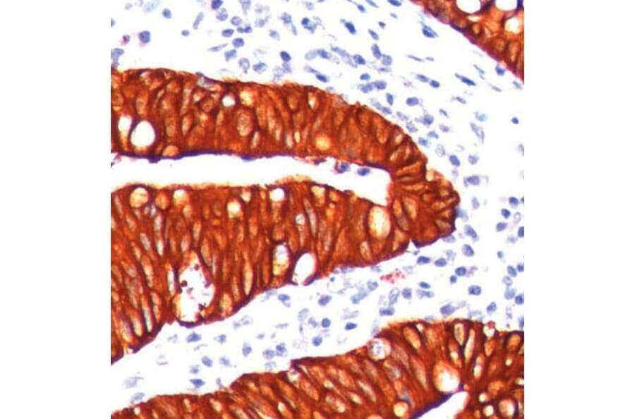 Validation Data - Anti-Melanoma Associated Antigen KBA.62 Antibody [G062.1] (A304480)
