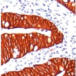 Validation Data - Anti-Melanoma Associated Antigen KBA.62 Antibody [G062.1] (A304480)