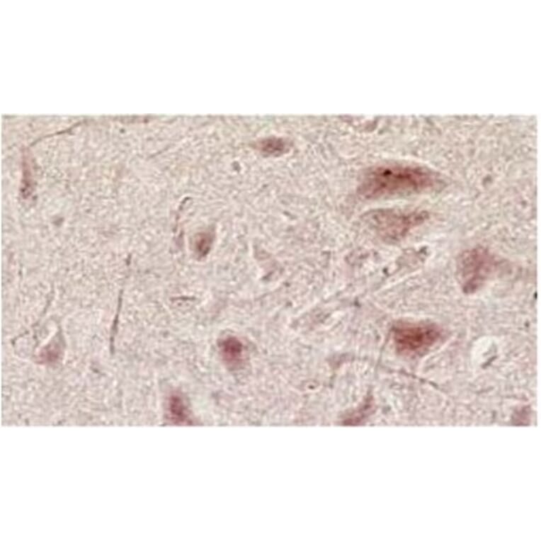 Validation Data - Anti-Glutamate NMDA Receptor NR3A/B Subunit Antibody [K35/40] - BSA and Azide free (A304484)