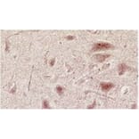 Validation Data - Anti-Glutamate NMDA Receptor NR3A/B Subunit Antibody [K35/40] - BSA and Azide free (A304484)