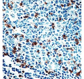 Validation Data - Anti-CD57 Antibody [G539.1] (A304485)