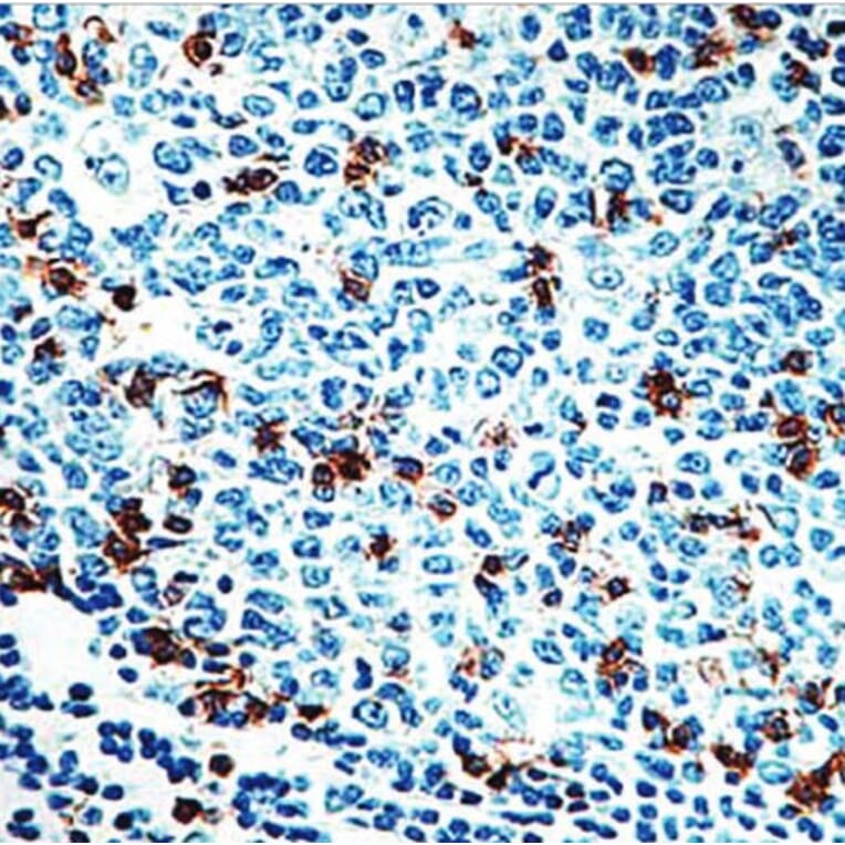 Validation Data - Anti-CD57 Antibody [G539.1] (A304485)