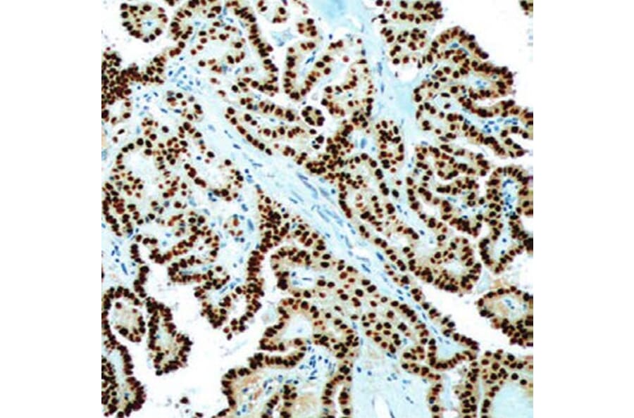 Validation Data - Anti-PAX-8 Antibody [G008.1] (A304555)