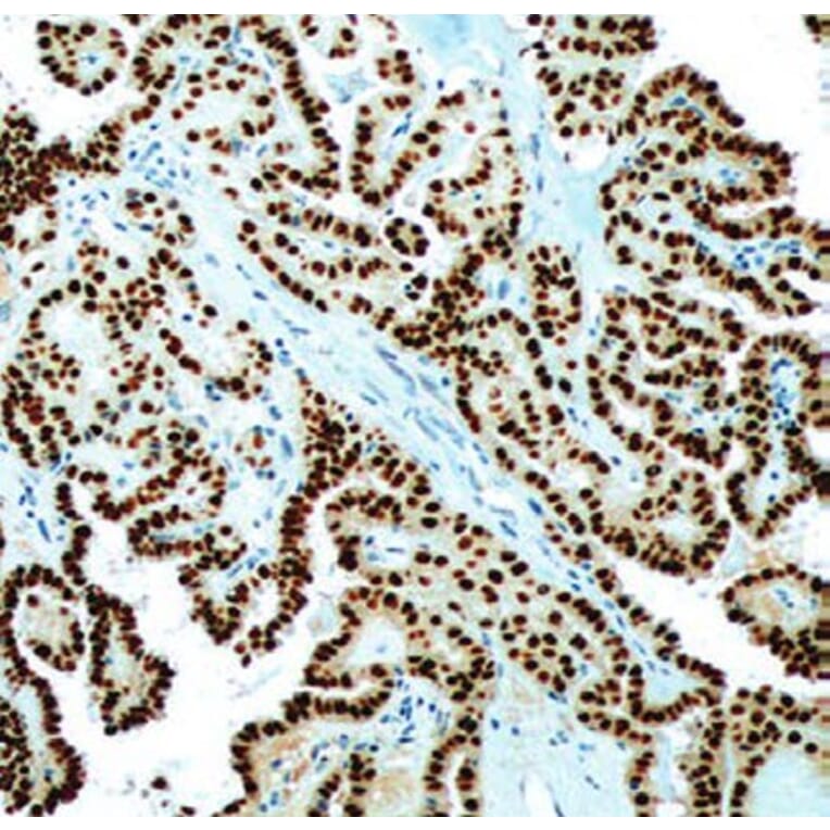 Validation Data - Anti-PAX-8 Antibody [G008.1] (A304555)