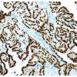 Validation Data - Anti-PAX-8 Antibody [G008.1] (A304555)