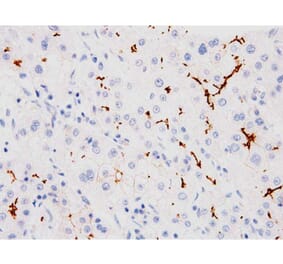 Validation Data - Anti-ABCB11 Antibody [G518.1] (A304569)