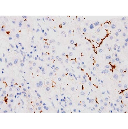 Validation Data - Anti-ABCB11 Antibody [G518.1] (A304569)