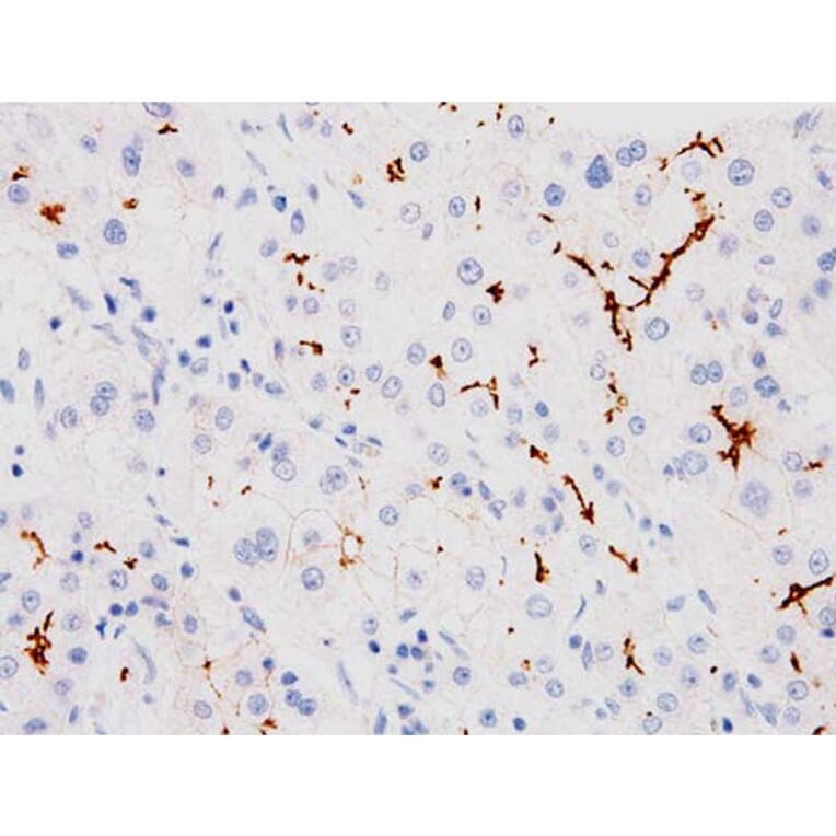 Validation Data - Anti-ABCB11 Antibody [G518.1] (A304569)