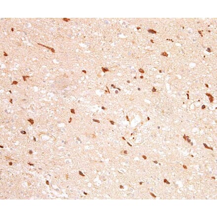 Validation Data - Anti-IDH1 Antibody [G132.1] (A304571)