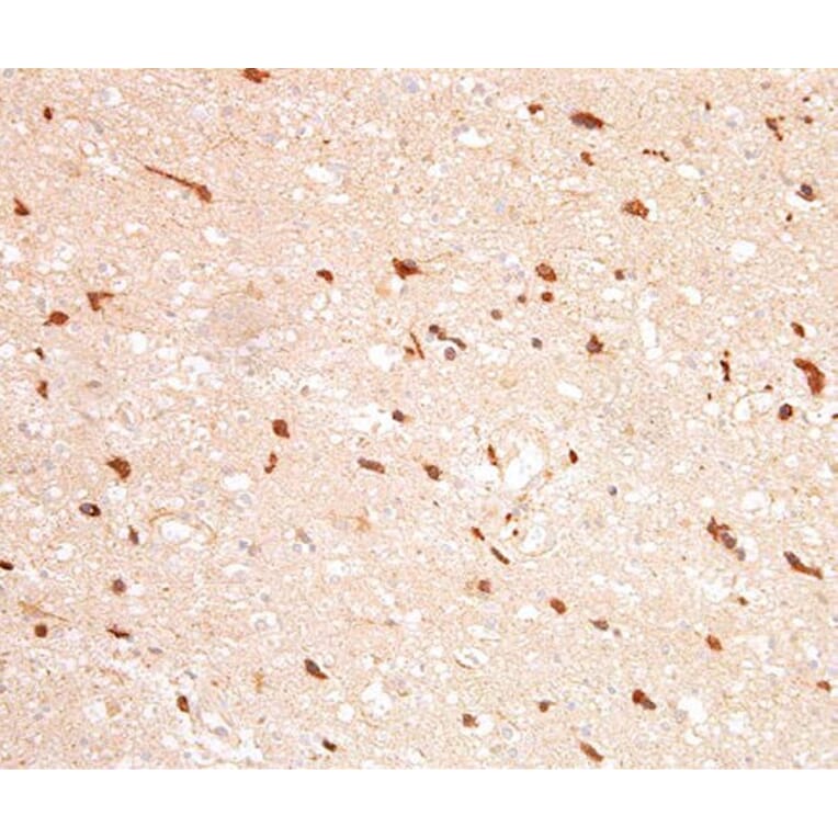 Validation Data - Anti-IDH1 Antibody [G132.1] (A304571)