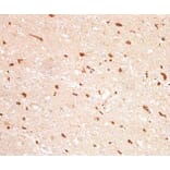 Validation Data - Anti-IDH1 Antibody [G132.1] (A304571)