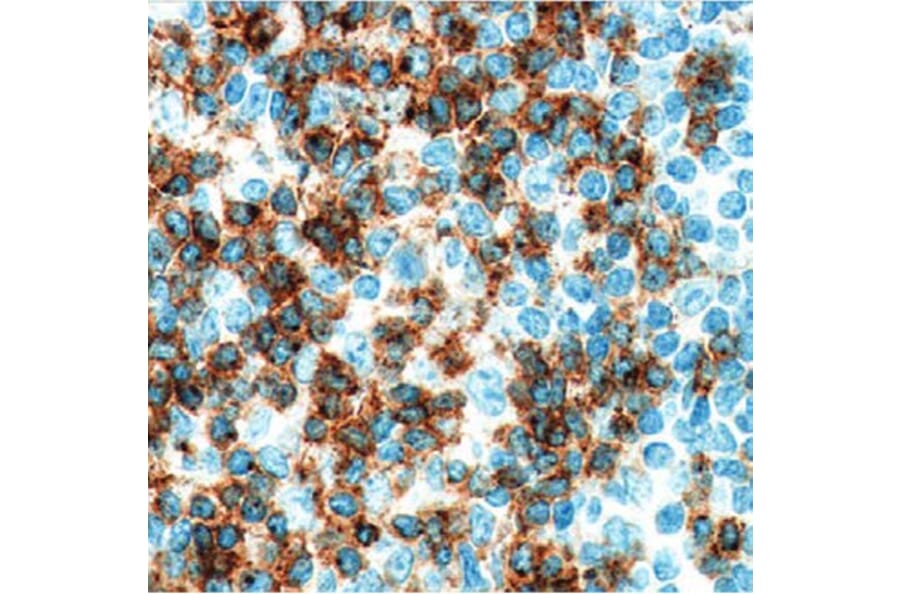 Validation Data - Anti-CD2 Antibody [G531.1] (A304572)