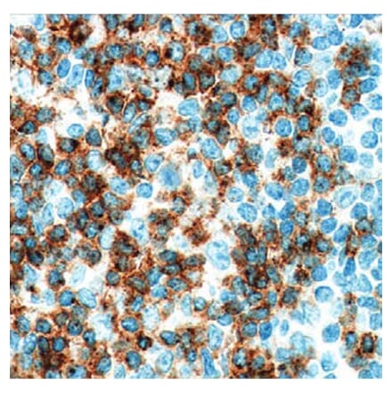 Validation Data - Anti-CD2 Antibody [G531.1] (A304572)