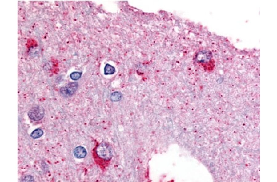 Validation Data - Anti-Glycogen Phosphorylase (brain) Antibody (A304574)