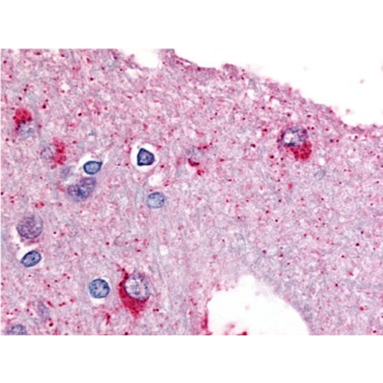 Validation Data - Anti-Glycogen Phosphorylase (brain) Antibody (A304574)