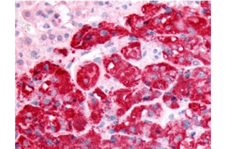 Validation Data - Anti-Sphingosine Kinase type 1 Antibody (A304576)