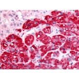 Validation Data - Anti-Sphingosine Kinase type 1 Antibody (A304576)