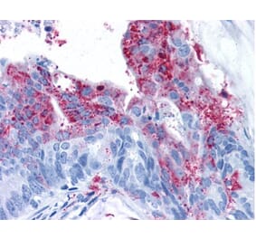 Validation Data - Anti-Tumor Endothelial Marker 5 Antibody (A304581)