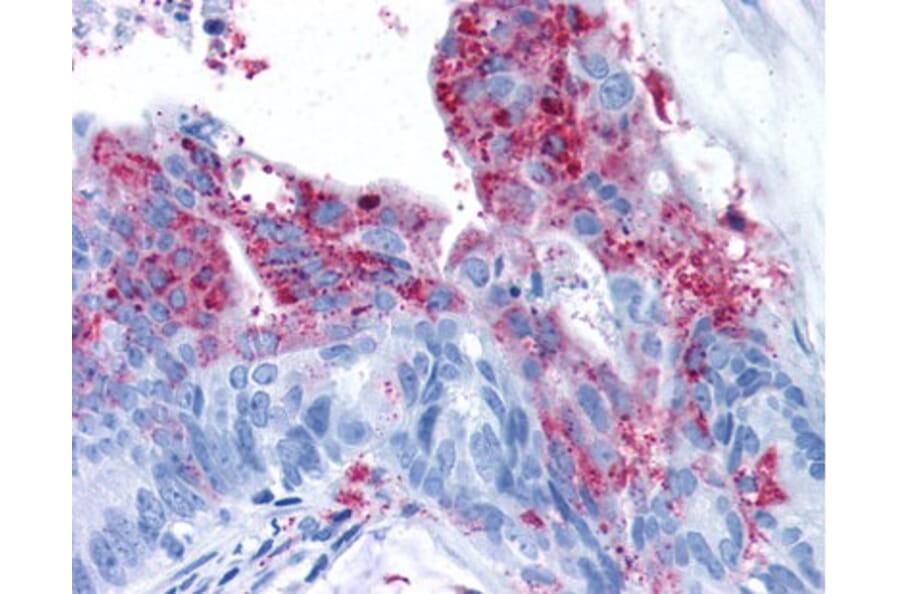 Validation Data - Anti-Tumor Endothelial Marker 5 Antibody (A304581)