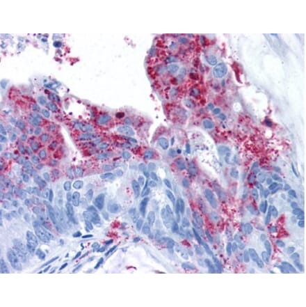 Validation Data - Anti-Tumor Endothelial Marker 5 Antibody (A304581)