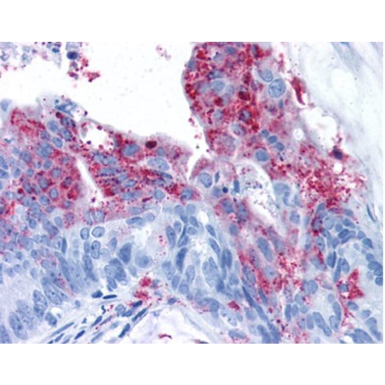 Validation Data - Anti-Tumor Endothelial Marker 5 Antibody (A304581)