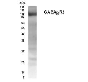 Validation Data - Anti-GABABR2 Antibody (A304625)