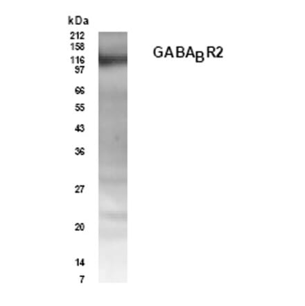 Validation Data - Anti-GABABR2 Antibody (A304625)