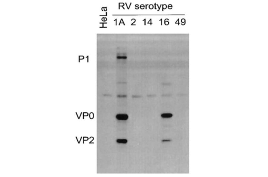 Validation Data - Anti-Rhinovirus 16 Antibody [R16-7] - BSA and Azide free (A304636)