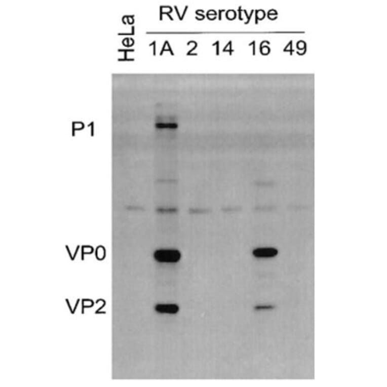 Validation Data - Anti-Rhinovirus 16 Antibody [R16-7] - BSA and Azide free (A304636)