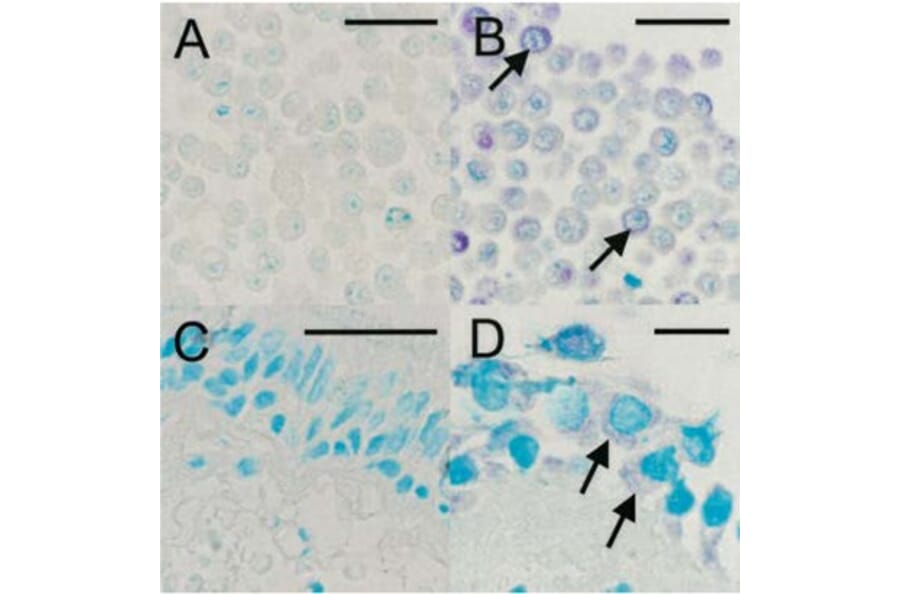 Validation Data - Anti-Rhinovirus 16 Antibody [R16-7] - BSA and Azide free (A304636)