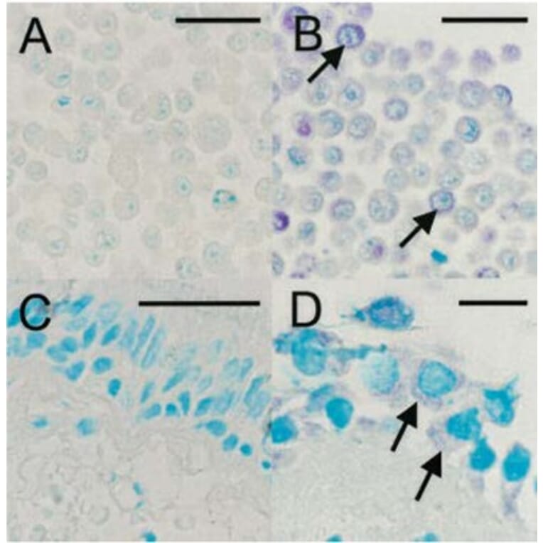 Validation Data - Anti-Rhinovirus 16 Antibody [R16-7] - BSA and Azide free (A304636)