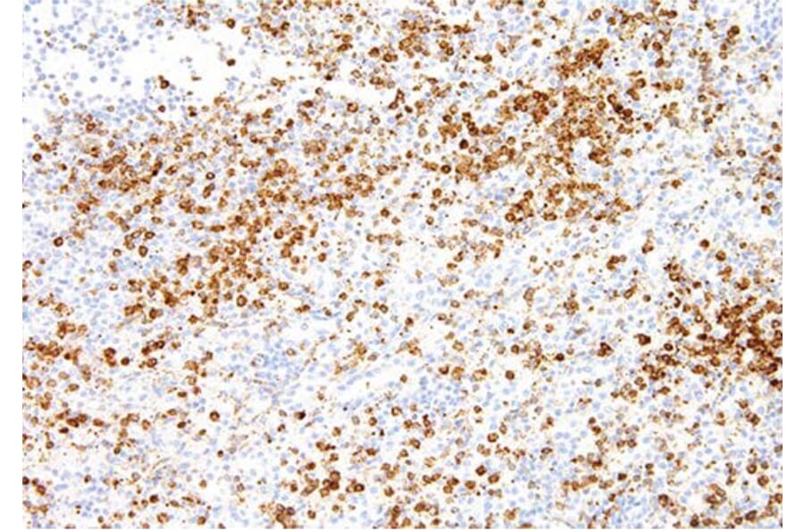 Validation Data - Anti-Annexin A1 Antibody [G512.1] (A304638)