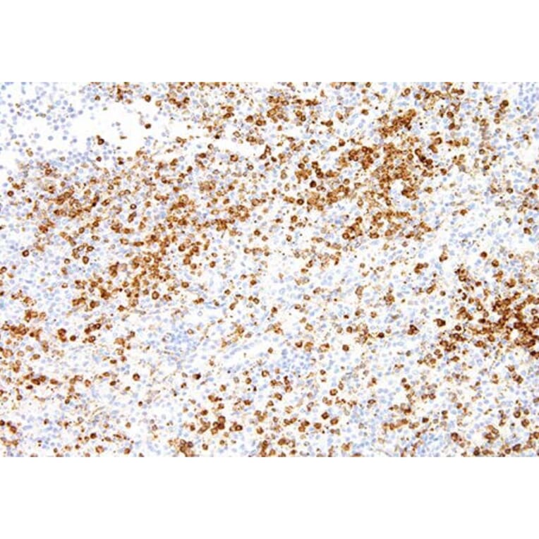 Validation Data - Anti-Annexin A1 Antibody [G512.1] (A304638)