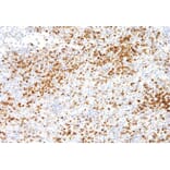 Validation Data - Anti-Annexin A1 Antibody [G512.1] (A304638)