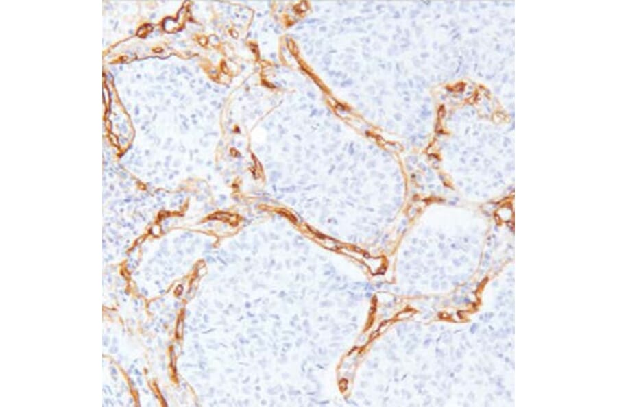 Validation Data - Anti-Collagen Type IV Antibody [G549.1] (A304639)
