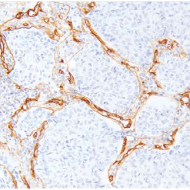 Validation Data - Anti-Collagen Type IV Antibody [G549.1] (A304639)