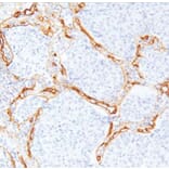 Validation Data - Anti-Collagen Type IV Antibody [G549.1] (A304639)