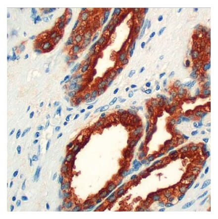 Validation Data - Anti-PSAP Antibody [G655.1] (A304641)