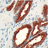 Validation Data - Anti-PSAP Antibody [G655.1] (A304641)