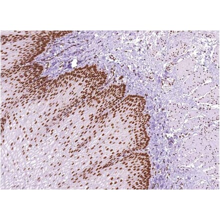 Validation Data - Anti-MLH1 Antibody [G409.1] (A304642)