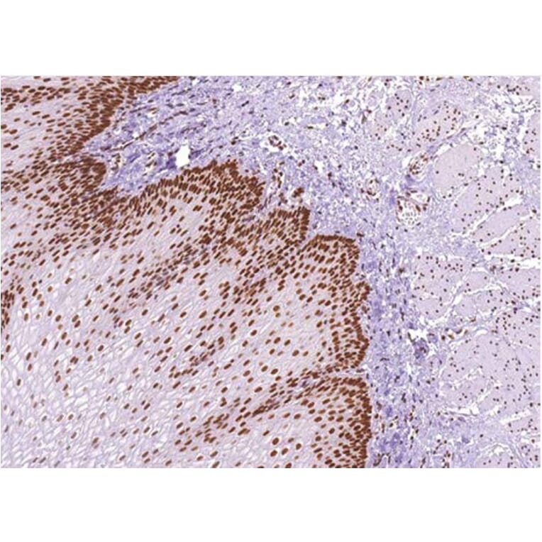 Validation Data - Anti-MLH1 Antibody [G409.1] (A304642)