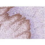 Validation Data - Anti-MLH1 Antibody [G409.1] (A304642)