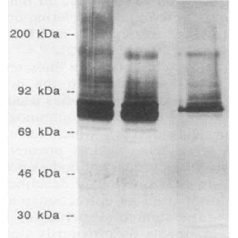 Validation Data - Anti-Streptococcus pneumoniae Antibody [XI126] - BSA and Azide free (A304645)