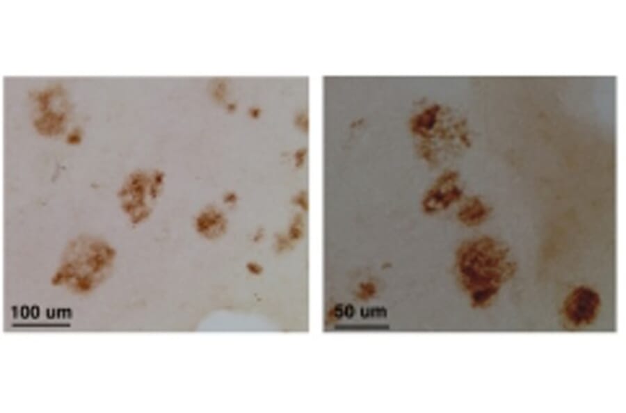 Validation Data - Anti-CLAC-P Antibody - BSA and Azide free (A304660)